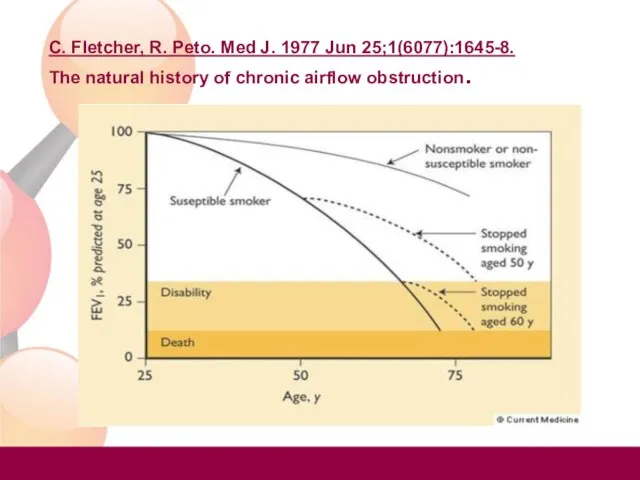 C. Fletcher, R. Peto. Med J. 1977 Jun 25;1(6077):1645-8. The natural history of chronic airflow obstruction.