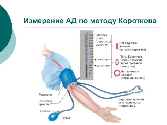 Измерение АД по методу Короткова