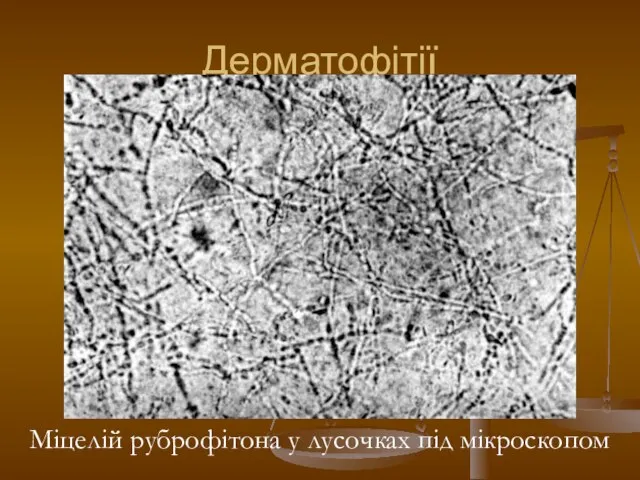 Дерматофітії Міцелій руброфітона у лусочках під мікроскопом