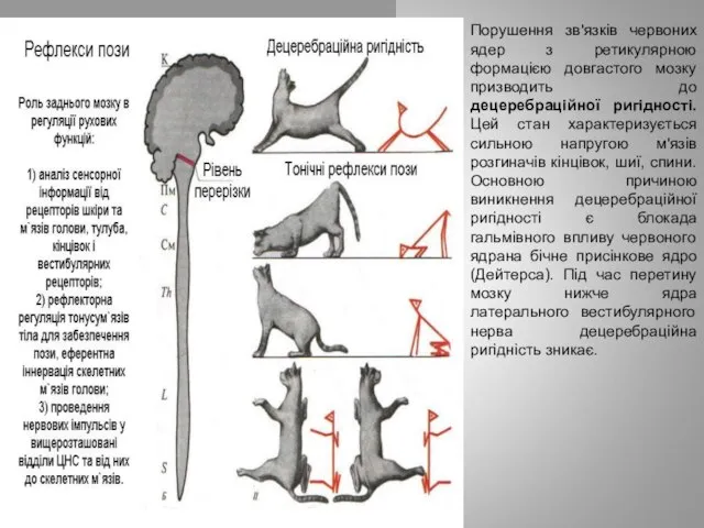 Порушення зв'язків червоних ядер з ретикулярною формацією довгастого мозку призводить до