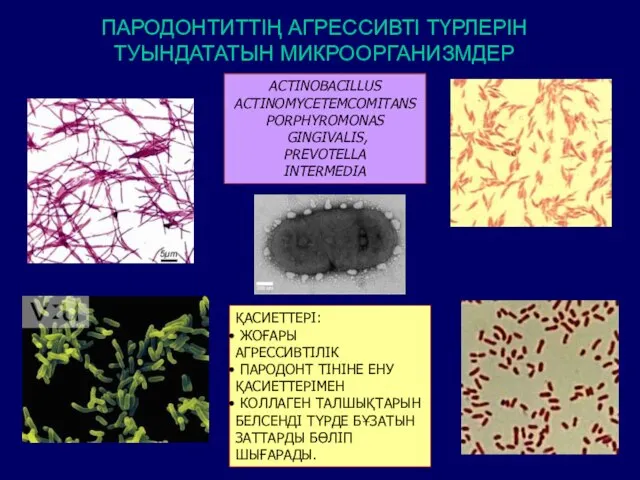 ПАРОДОНТИТТІҢ АГРЕССИВТІ ТҮРЛЕРІН ТУЫНДАТАТЫН МИКРООРГАНИЗМДЕР ACTINOBACILLUS ACTINOMYCETEMCOMITANS PORPHYROMONAS GINGIVALIS, PREVOTELLA INTERMEDIA