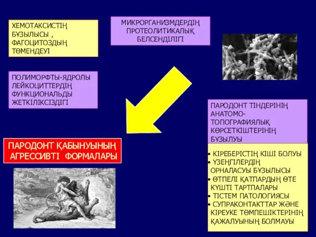 ПАРОДОНТ ҚАБЫНУЫНЫҢ АГРЕССИВТІ ФОРМАЛАРЫ МИКРОРГАНИЗМДЕРДІҢ ПРОТЕОЛИТИКАЛЫҚ БЕЛСЕНДІЛІГІ ПОЛИМОРФТЫ-ЯДРОЛЫ ЛЕЙКОЦИТТЕРДІҢ ФУНКЦИОНАЛЬДЫ ЖЕТКІЛІКСІЗДІГІ