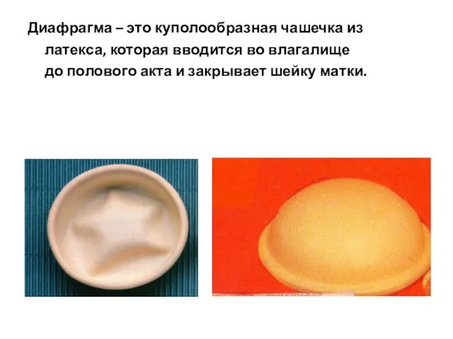 Диафрагма – это куполообразная чашечка из латекса, которая вводится во влагалище