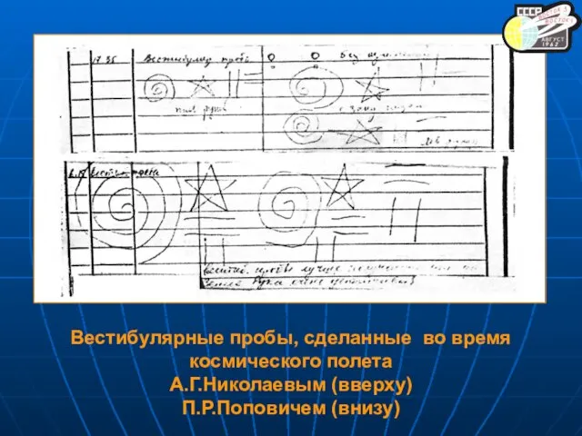 Вестибулярные пробы, сделанные во время космического полета А.Г.Николаевым (вверху) П.Р.Поповичем (внизу)