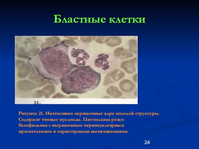 Бластные клетки Рисунок 21. Интенсивно окрашенные ядра молодой структуры. Содержат темные