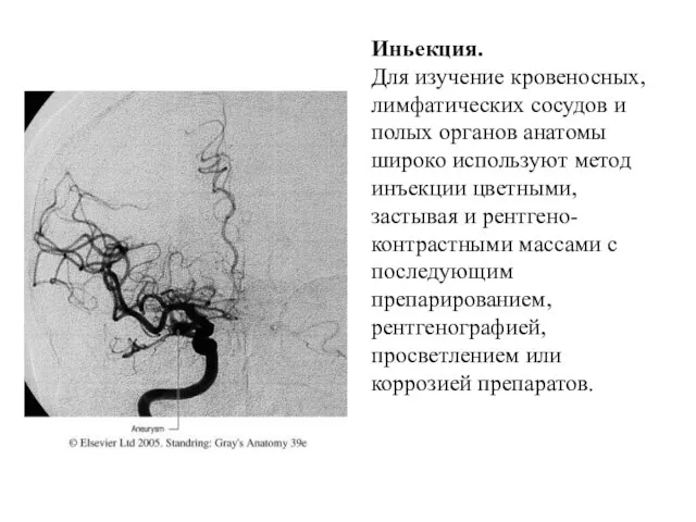 Иньекция. Для изучение кровеносных, лимфатических сосудов и полых органов анатомы широко