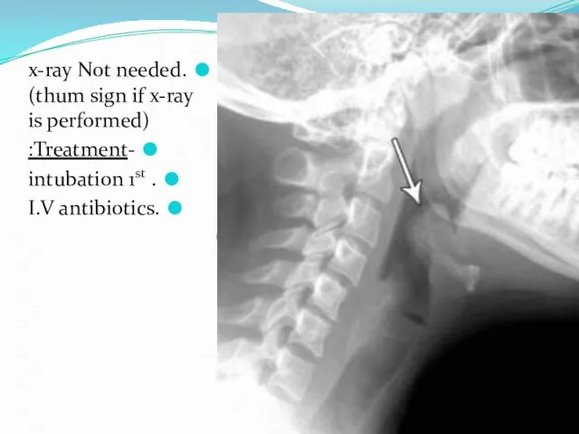 .x-ray Not needed (thum sign if x-ray is performed) -Treatment: . intubation 1st .I.V antibiotics