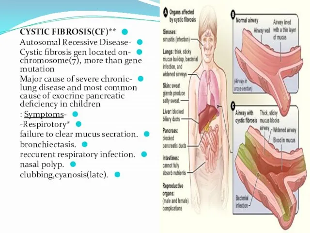 **CYSTIC FIBROSIS(CF) -Autosomal Recessive Disease -Cystic fibrosis gen located on chromosome(7),