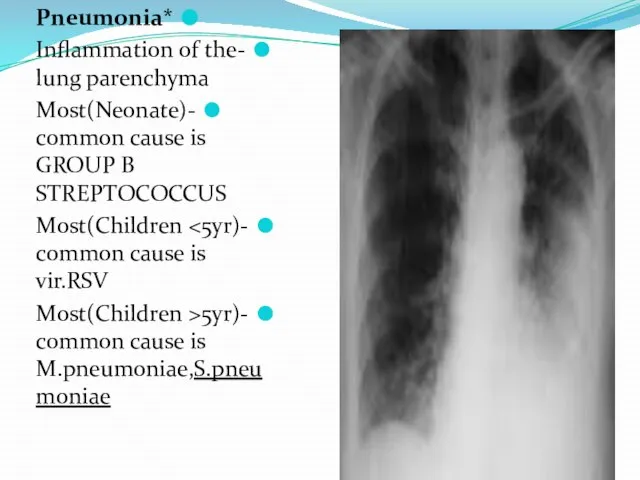 *Pneumonia -Inflammation of the lung parenchyma -(Neonate)Most common cause is GROUP