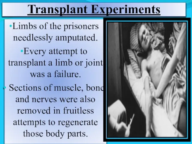 Transplant Experiments Limbs of the prisoners needlessly amputated. Every attempt to