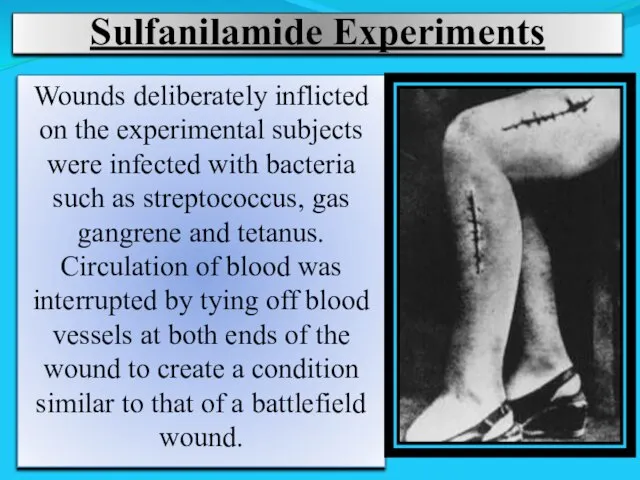 Sulfanilamide Experiments Wounds deliberately inflicted on the experimental subjects were infected