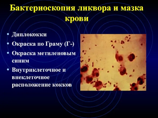 Бактериоскопия ликвора и мазка крови Диплококки Окраска по Граму (Г-) Окраска