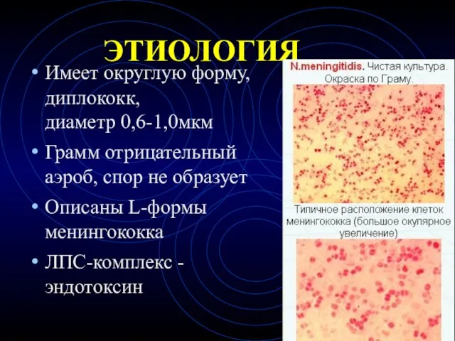 ЭТИОЛОГИЯ Имеет округлую форму, диплококк, диаметр 0,6-1,0мкм Грамм отрицательный аэроб, спор