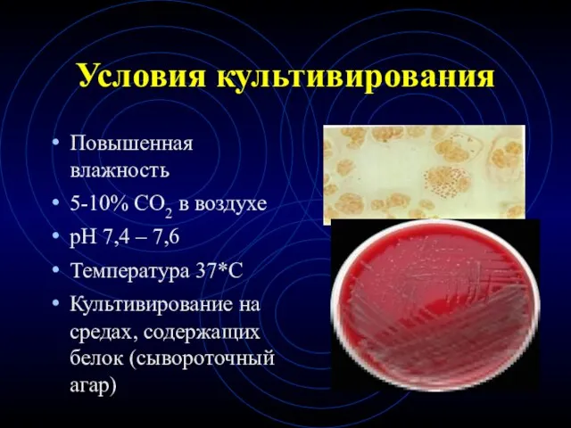 Условия культивирования Повышенная влажность 5-10% СО2 в воздухе рН 7,4 –