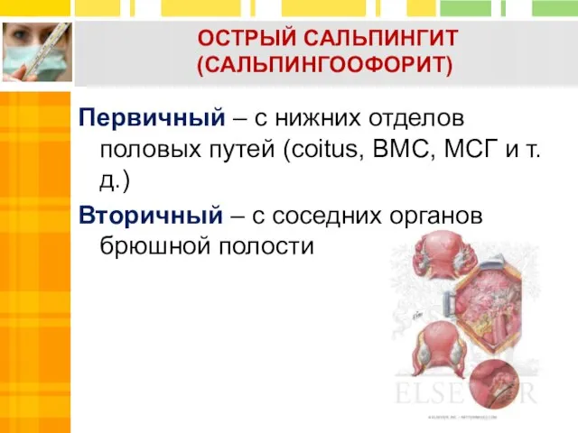 Первичный – с нижних отделов половых путей (coitus, ВМС, МСГ и