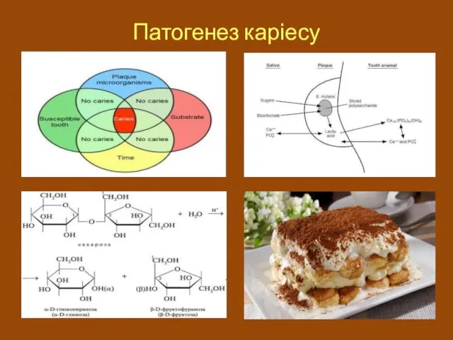 Патогенез каріесу