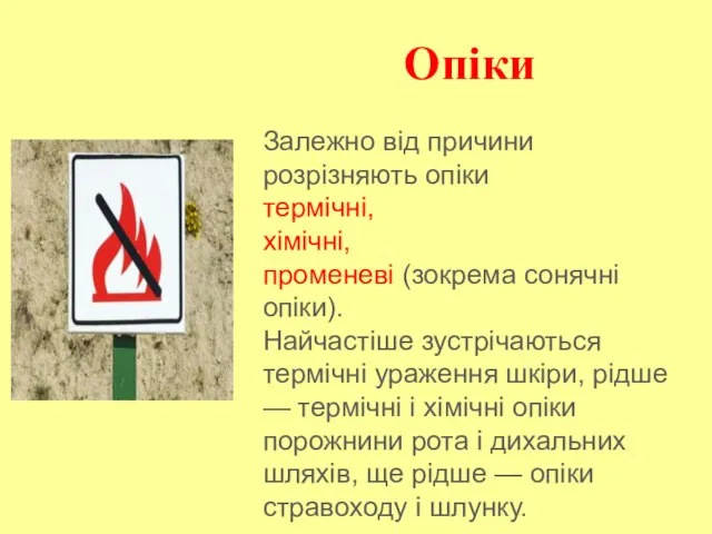 Опіки Залежно від причини розрізняють опіки термічні, хімічні, променеві (зокрема сонячні