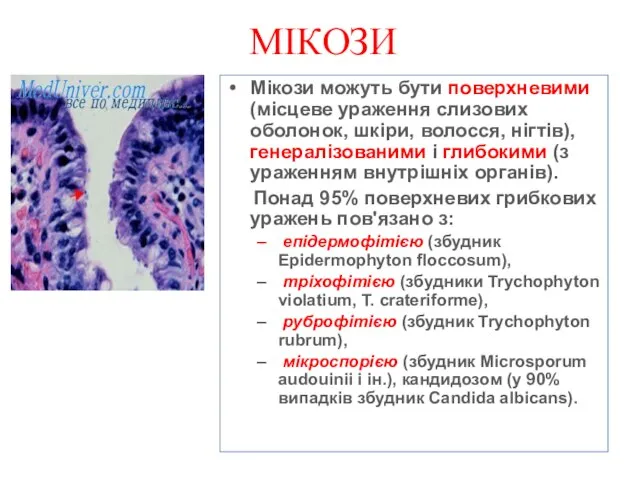 МІКОЗИ Мікози можуть бути поверхневими (місцеве ураження слизових оболонок, шкіри, волосся,