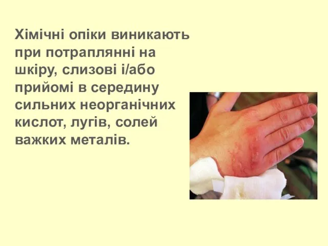 Хімічні опіки виникають при потраплянні на шкіру, слизові і/або прийомі в