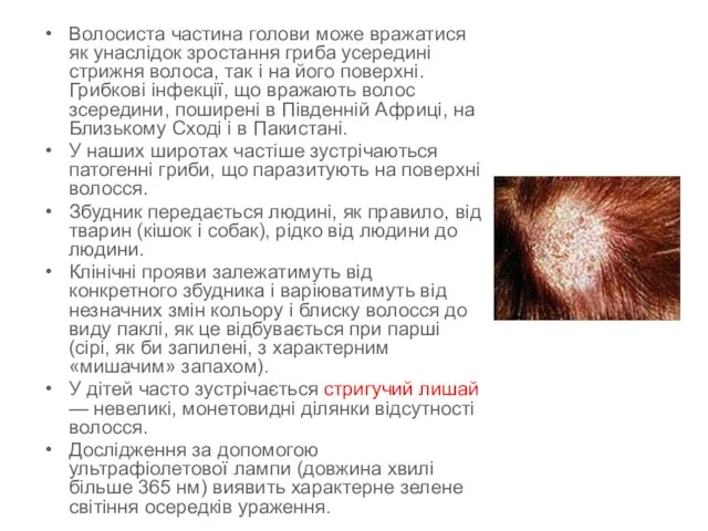 Волосиста частина голови може вражатися як унаслідок зростання гриба усередині стрижня