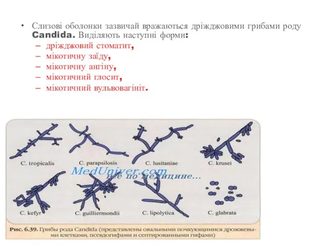Слизові оболонки зазвичай вражаються дріжджовими грибами роду Candida. Виділяють наступні форми: