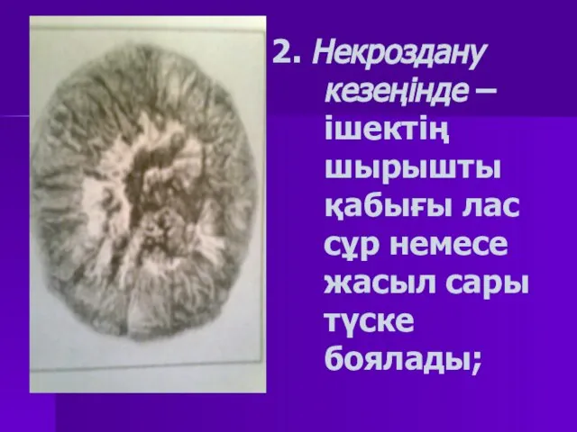 2. Некроздану кезеңінде – ішектің шырышты қабығы лас сұр немесе жасыл сары түске боялады;