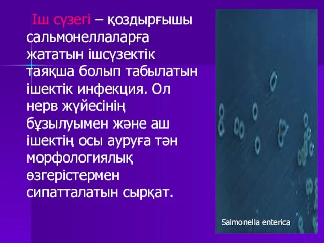 Іш сүзегі – қоздырғышы сальмонеллаларға жататын ішсүзектік таяқша болып табылатын ішектік