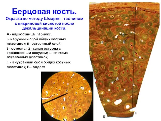 Берцовая кость. Окраска по методу Шморля - тионином с пикриновой кислотой