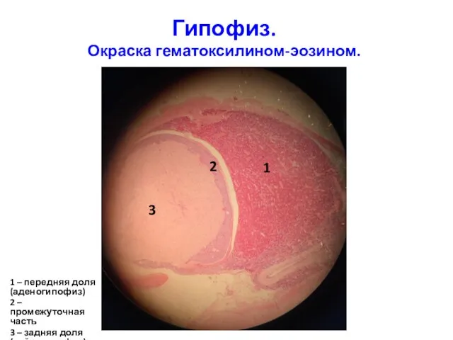 Гипофиз. Окраска гематоксилином-эозином. 1 – передняя доля (аденогипофиз) 2 – промежуточная