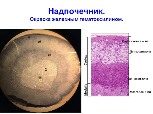 Надпочечник. Окраска железным гематоксилином. 2 1а 1б 1в Мозговое в-во Сетчатая зона Пучковая зона Клубочковая зона