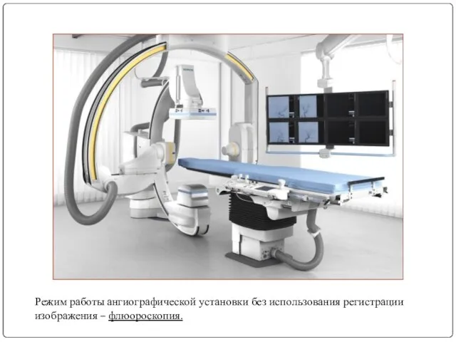 Режим работы ангиографической установки без использования регистрации изображения – флюороскопия.