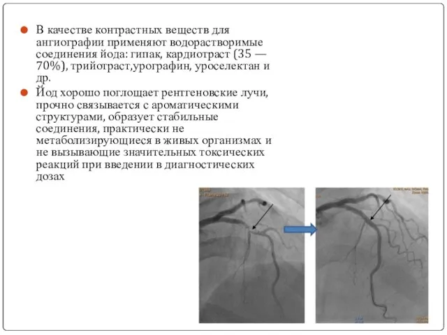 В качестве контрастных веществ для ангиографии применяют водорастворимые соединения йода: гипак,