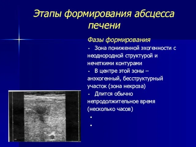 Этапы формирования абсцесса печени Фазы формирования Зона пониженной эхогенности с неоднородной