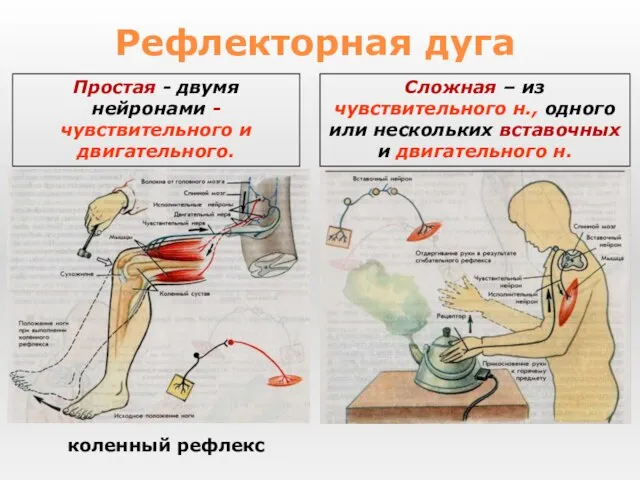 коленный рефлекс Рефлекторная дуга Простая - двумя нейронами - чувствительного и