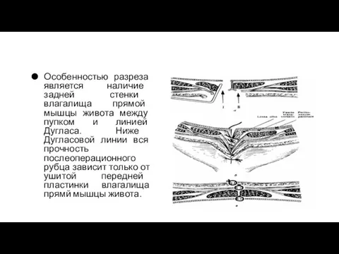 Особенностью разреза является наличие задней стенки влагалища прямой мышцы живота между