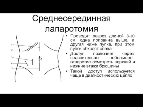 Среднесерединная лапаротомия Проводят разрез длиной 8-10 см, одна половина выше, а