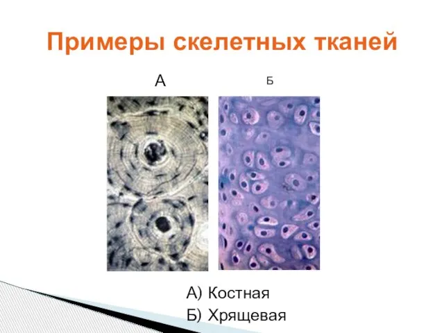 А) Костная Б) Хрящевая Примеры скелетных тканей А Б