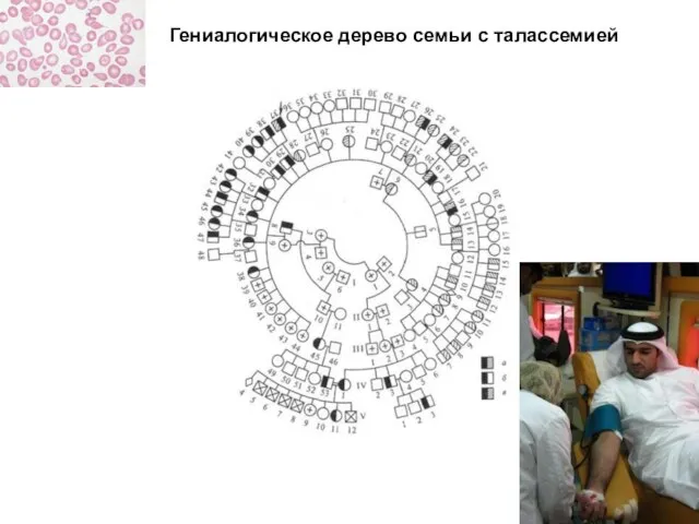 Гениалогическое дерево семьи с талассемией