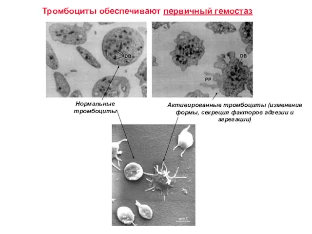 Тромбоциты обеспечивают первичный гемостаз Нормальные тромбоциты Активированные тромбоциты (изменение формы, секреция факторов адгезии и агрегации)