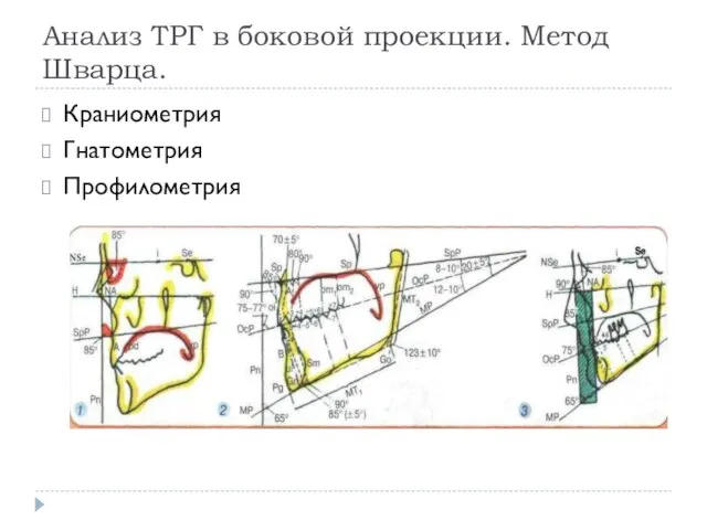 Анализ ТРГ в боковой проекции. Метод Шварца. Краниометрия Гнатометрия Профилометрия