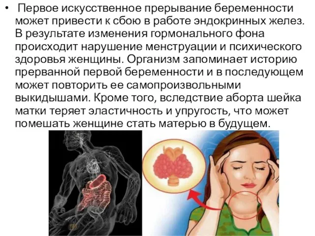 Первое искусственное прерывание беременности может привести к сбою в работе эндокринных