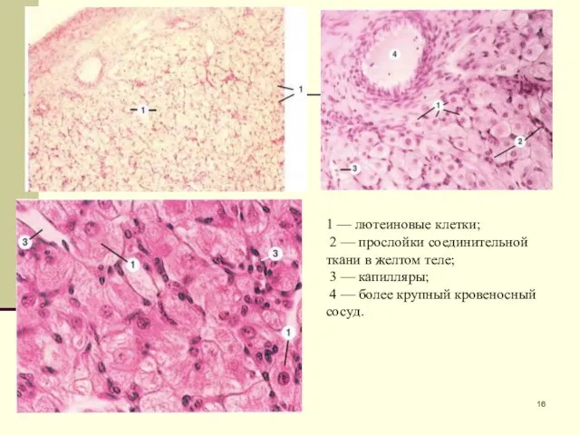 1 — лютеиновые клетки; 2 — прослойки соединительной ткани в желтом