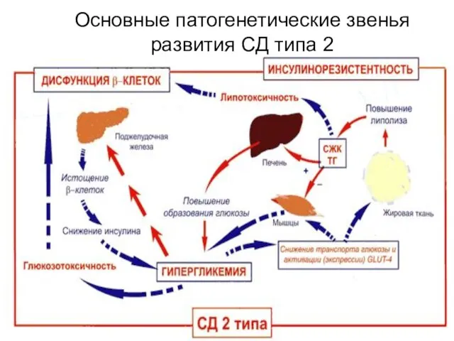 Основные патогенетические звенья развития СД типа 2