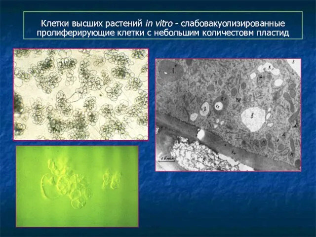 Клетки высших растений in vitro - слабовакуолизированные пролиферирующие клетки с небольшим количестовм пластид