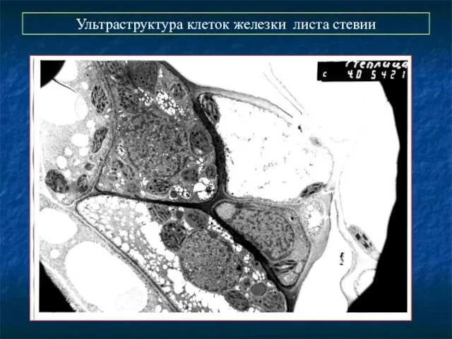 Ультраструктура клеток железки листа стевии