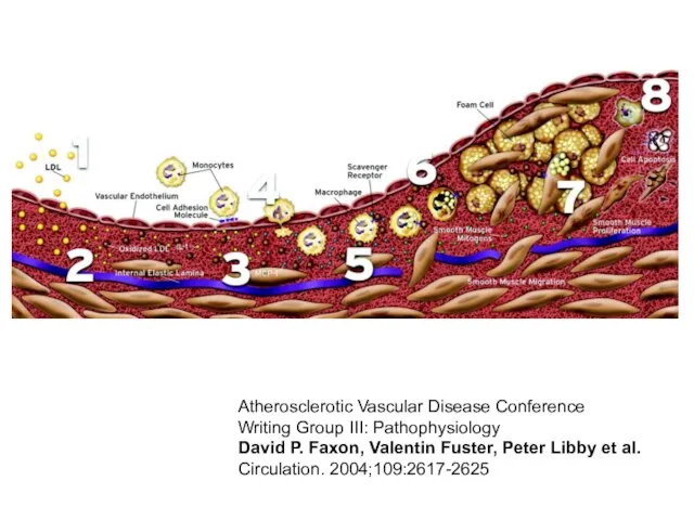 Atherosclerotic Vascular Disease Conference Writing Group III: Pathophysiology David P. Faxon,