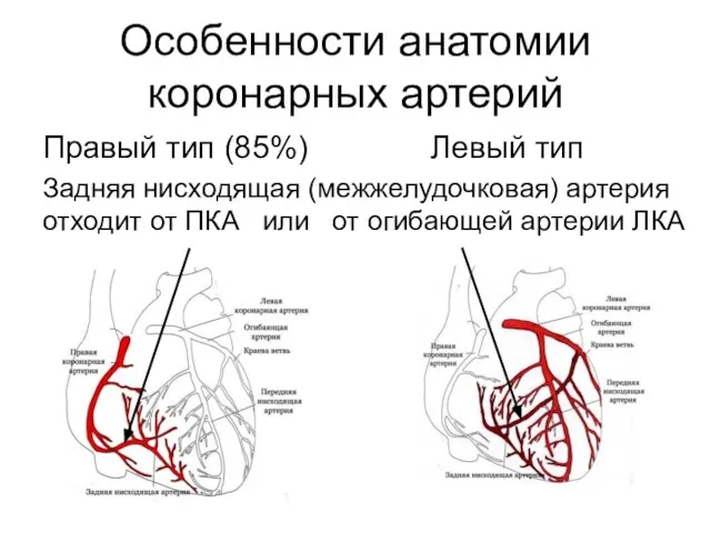 Особенности анатомии коронарных артерий Правый тип (85%) Левый тип Задняя нисходящая