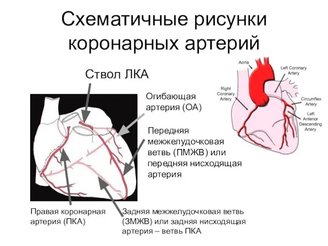Схематичные рисунки коронарных артерий Ствол ЛКА Огибающая артерия (ОА) Передняя межжелудочковая