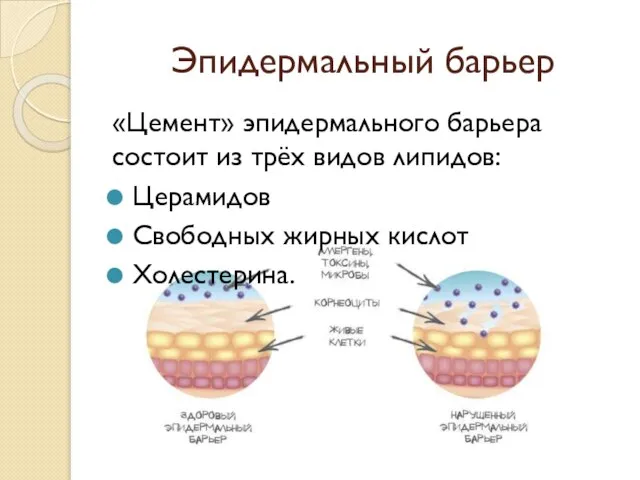 Эпидермальный барьер «Цемент» эпидермального барьера состоит из трёх видов липидов: Церамидов Свободных жирных кислот Холестерина.