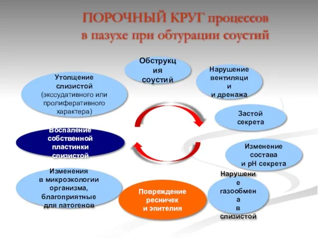 ПОРОЧНЫЙ КРУГ процессов в пазухе при обтурации соустий Обструкция соустий Утолщение